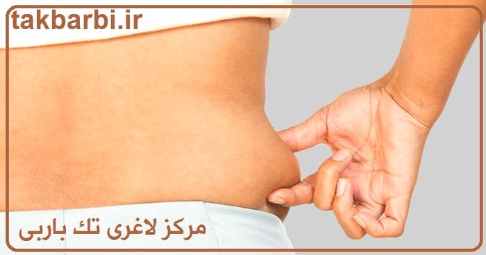 تفاوت لیپوساکشن و ابدومینوپلاستی