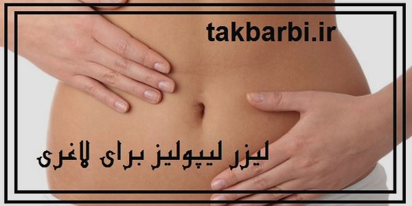 ليزر ليپوليز چیست