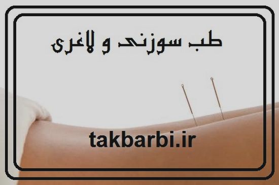طب سوزنی و کاهش وزن