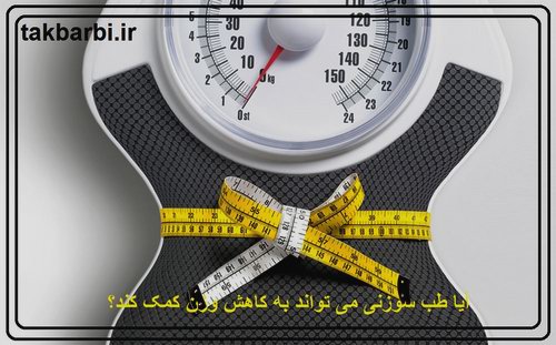 آیا طب سوزنی برای کاهش وزن مفید است