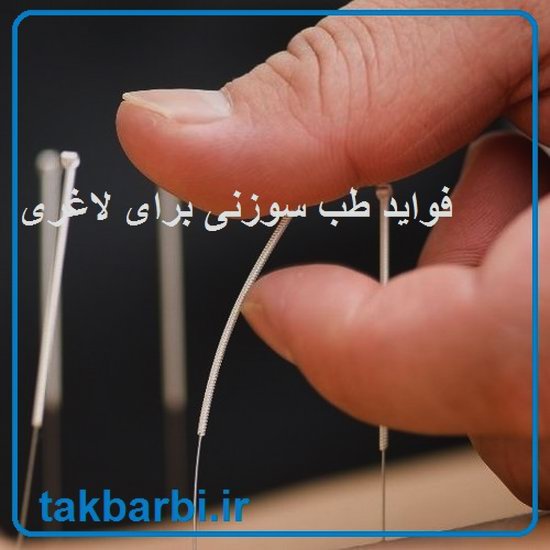 تاثیر طب سوزنی در کاهش وزن