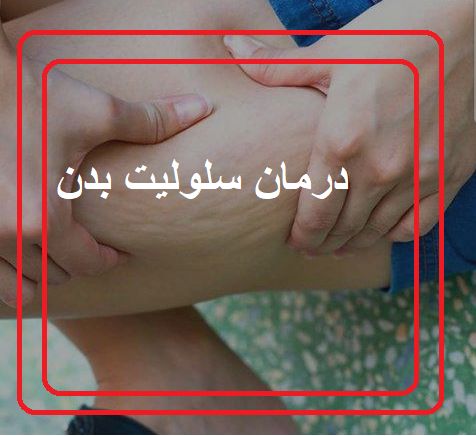 درمان سلولیت
