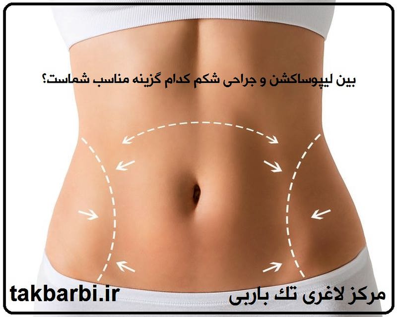 ایا لیپوساکشن عوارض دارد ؟