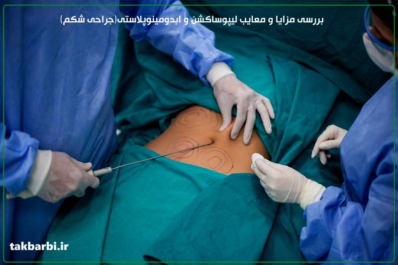 ایا لیپوساکشن عوارض دارد ؟