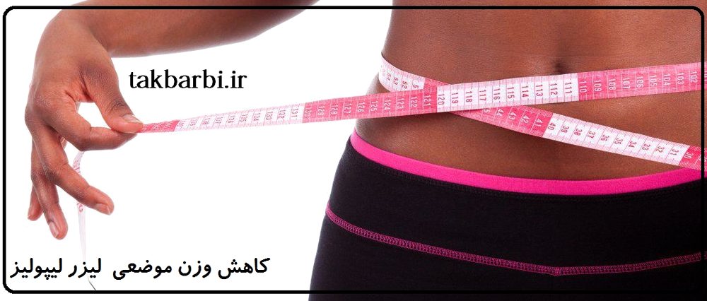 کاهش وزن موضعی