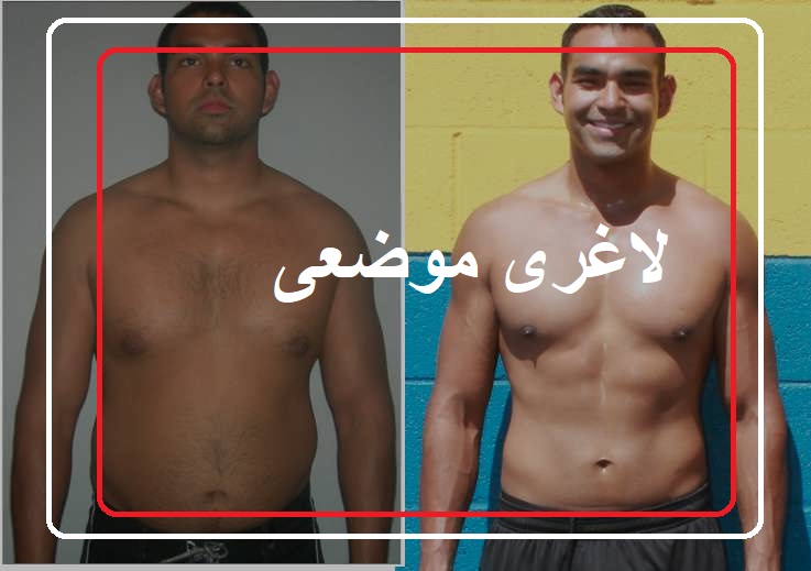 لاغری موضعی بدن