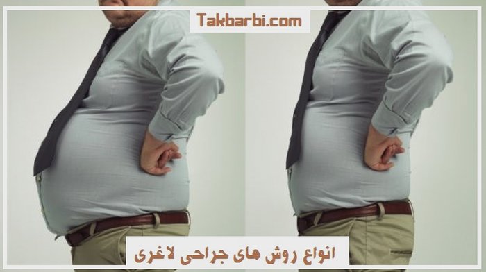 لاغری موضعی در پونک