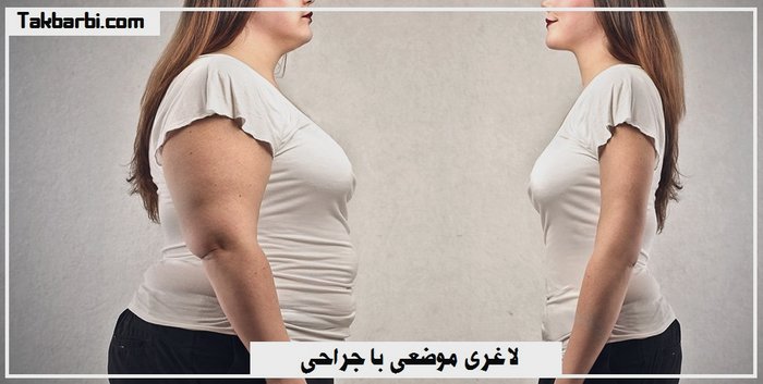 لاغری موضعی با روش های جراحی و ماساژ