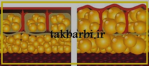 سلولیت به چه معناست