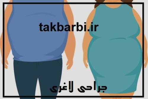 جدیدترین متد جراحی لاغری