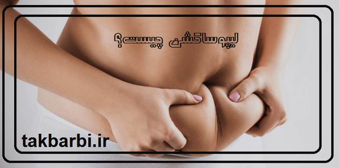 لیپوساکشن چیست ؟