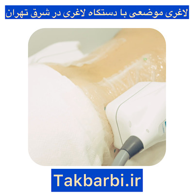 لاغری موضعی در شرق تهران