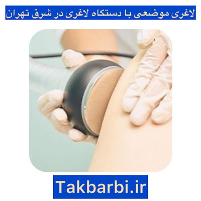 لاغری موضعی در شرق تهران