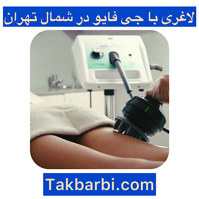 جی فایو در شمال تهران