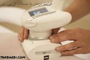 فرایند درمان با دستگاه ال پی جی