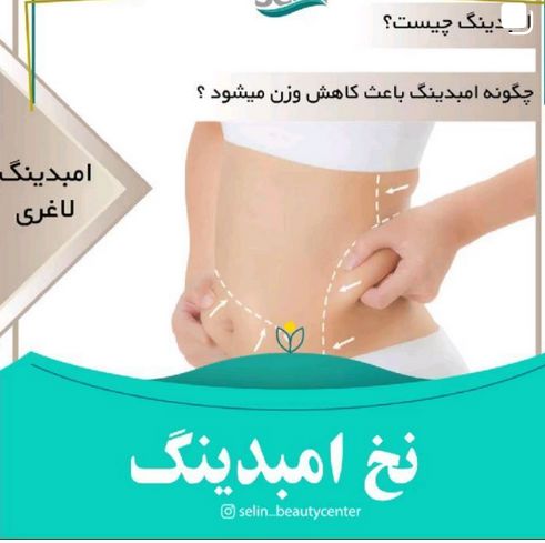 نخ امبدینگ در صادقیه تهران