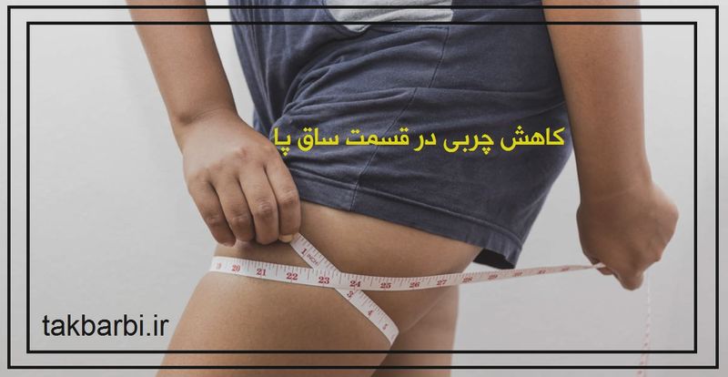 لاغری موضعی